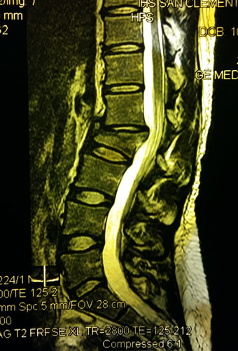 Jackie Wu X-Ray